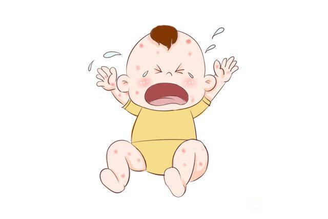 婴儿红疹子(婴儿起红点疹子)
