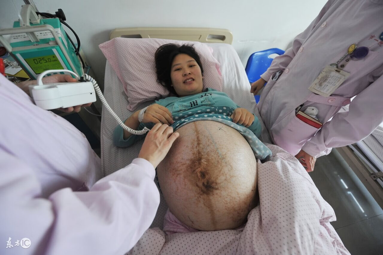 孕妇正常血压范围内(怀孕血压正常值是多少范围)