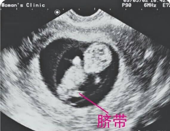 怀孕8个月胎儿b超图片(怀孕四个月b超图)