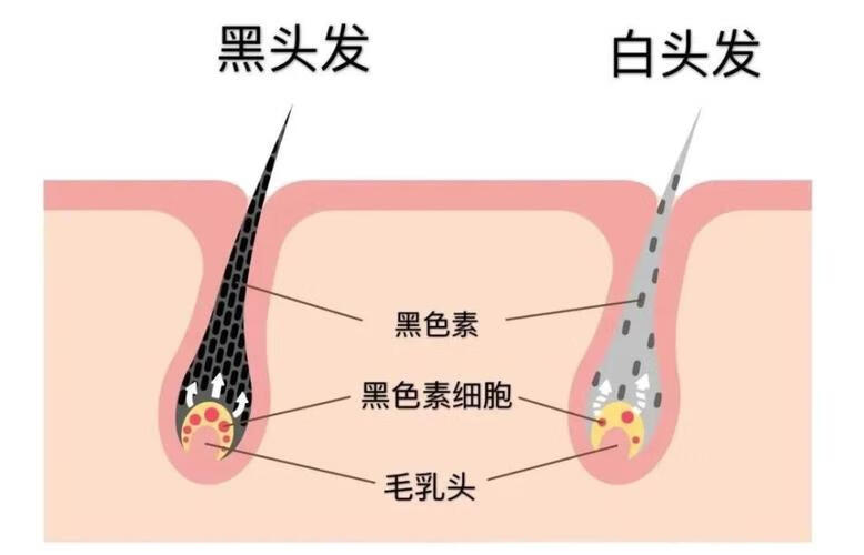 德洛莉丝白发转黑发图片