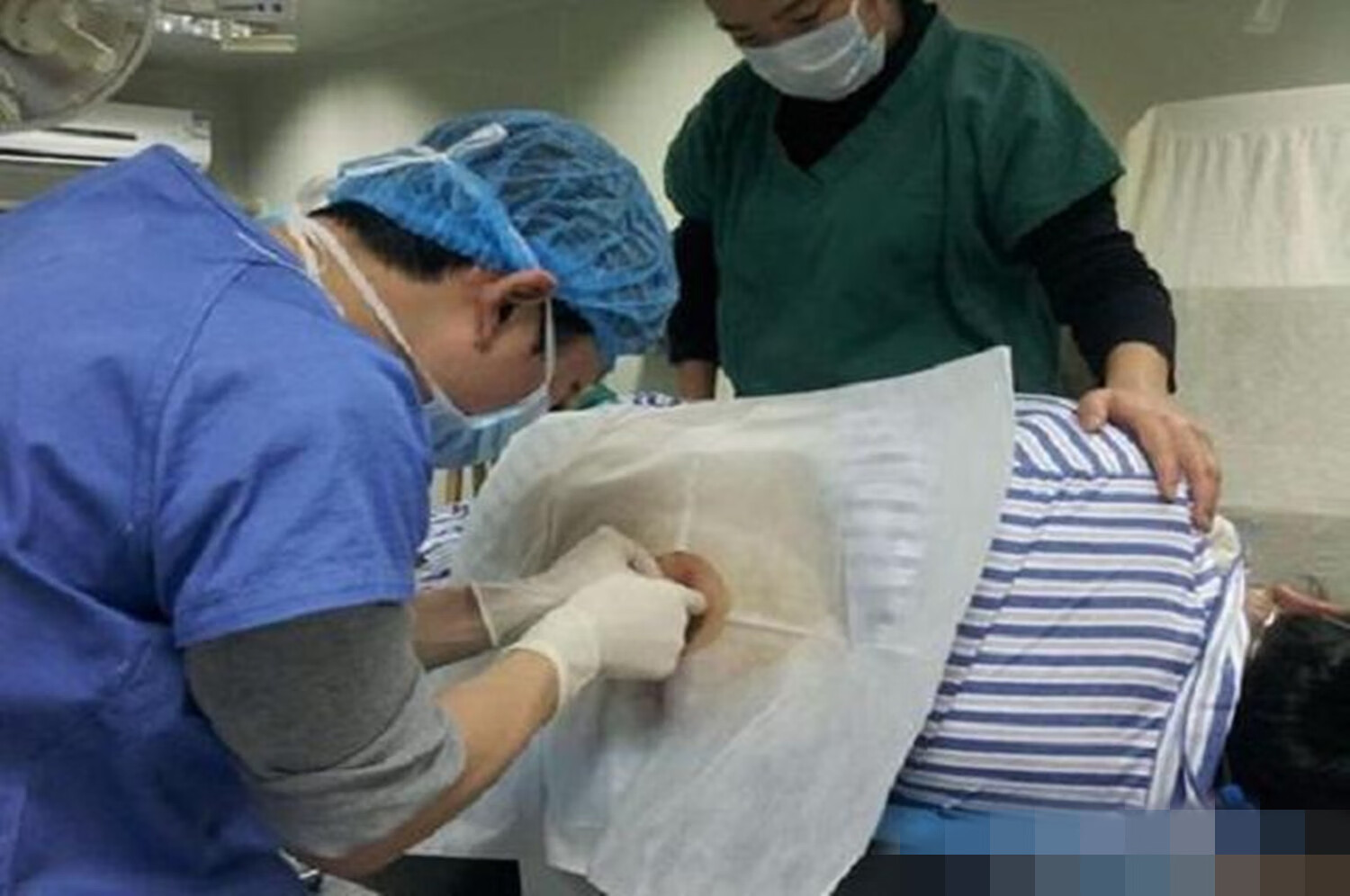 剖宫产和剖腹产的区别(剖腹产坐月子十大禁忌)