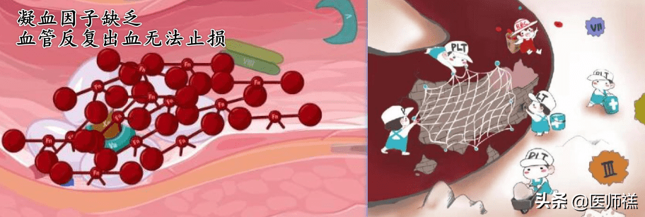 鼻子出血怎么回事儿