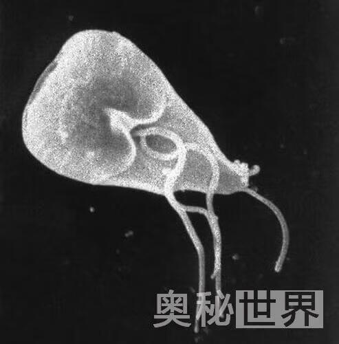 人体寄生虫有哪些(人体寄生虫图片)