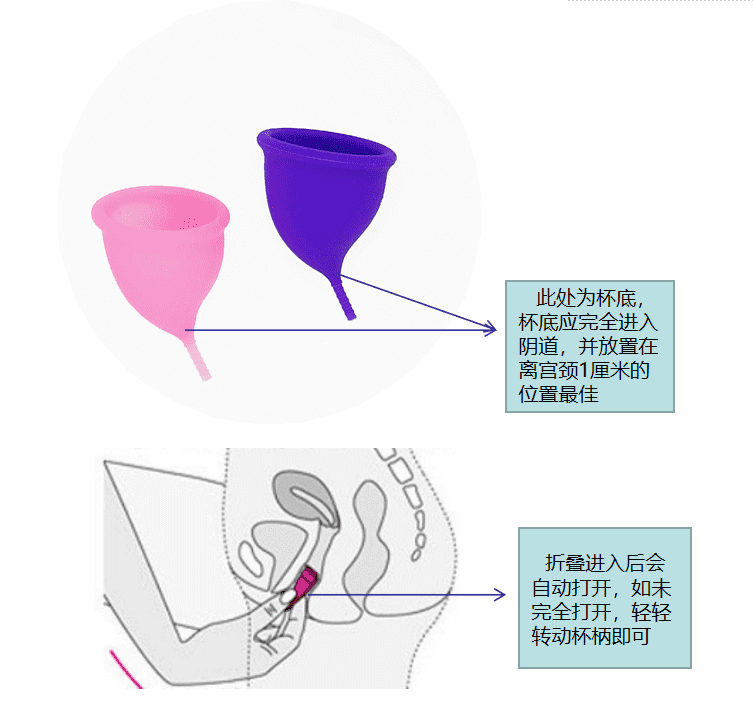 月亮杯(月亮杯戴上后的照片)