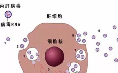得了丙肝能治好吗(得了丙肝就等于死亡)