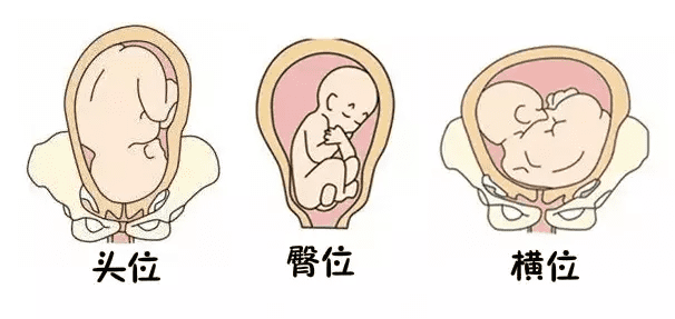 (1)胎儿生理指标双顶径,股骨长,头围等到底指的哪些部位呢?