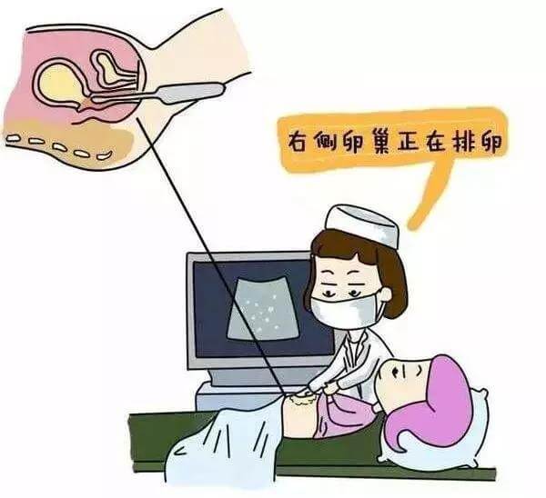 监测卵泡有什么作用(监测卵泡的方法)