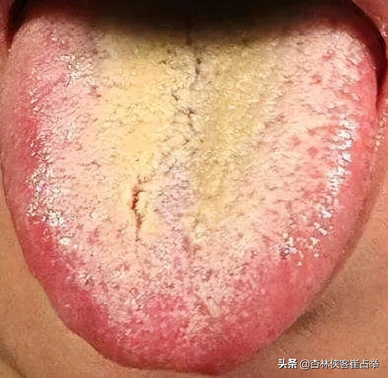 阴囊瘙痒(下面两侧瘙痒是什么原因造成的)