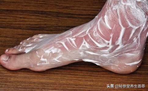 烫伤起泡怎么办?(烫伤起泡应该怎么处理)