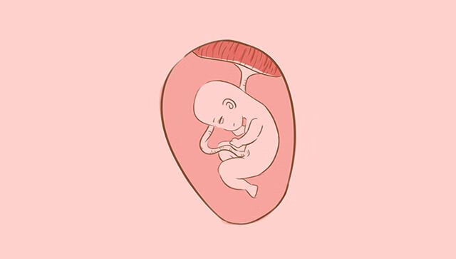 胎儿(胎儿在肚子里)