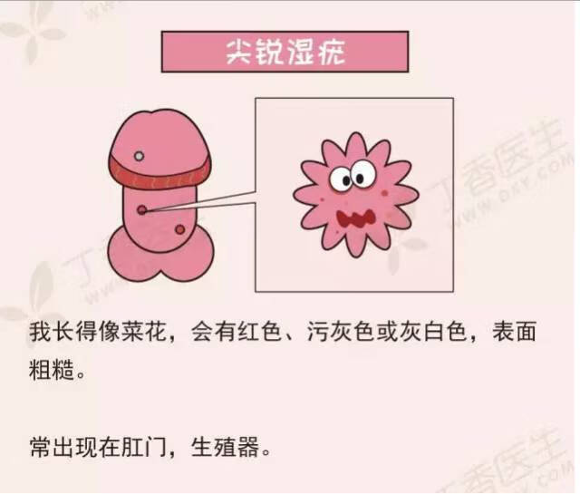 性疾病有哪几种都有哪些明显症状(男性得了性疾病有什么症状图片)