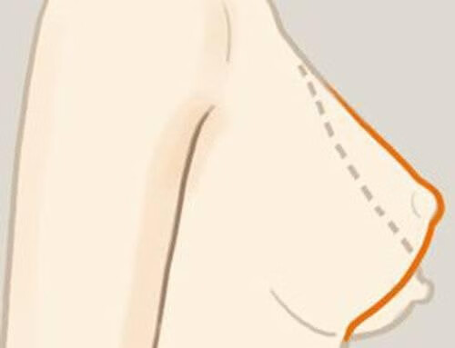 乳头下垂是什么原因造成的(乳房下垂是什么原因)