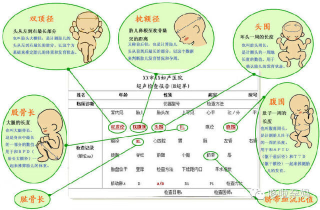 b超报告单图片(卵巢囊肿b超报告单)