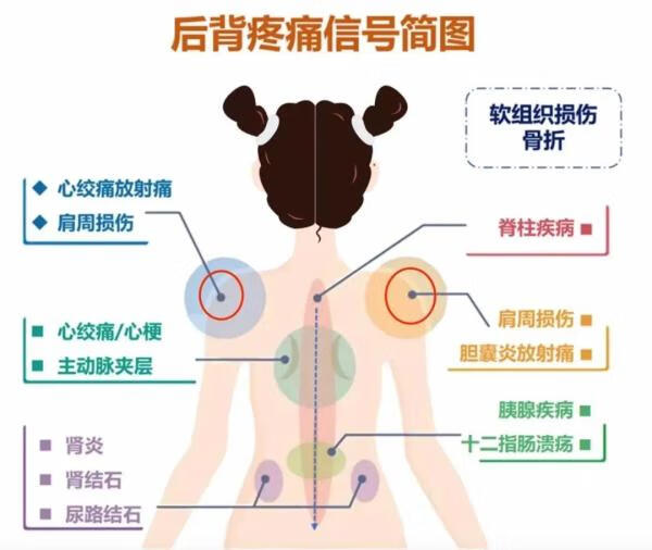 身体背部疼痛的原因(后背里面疼痛是什么原因)