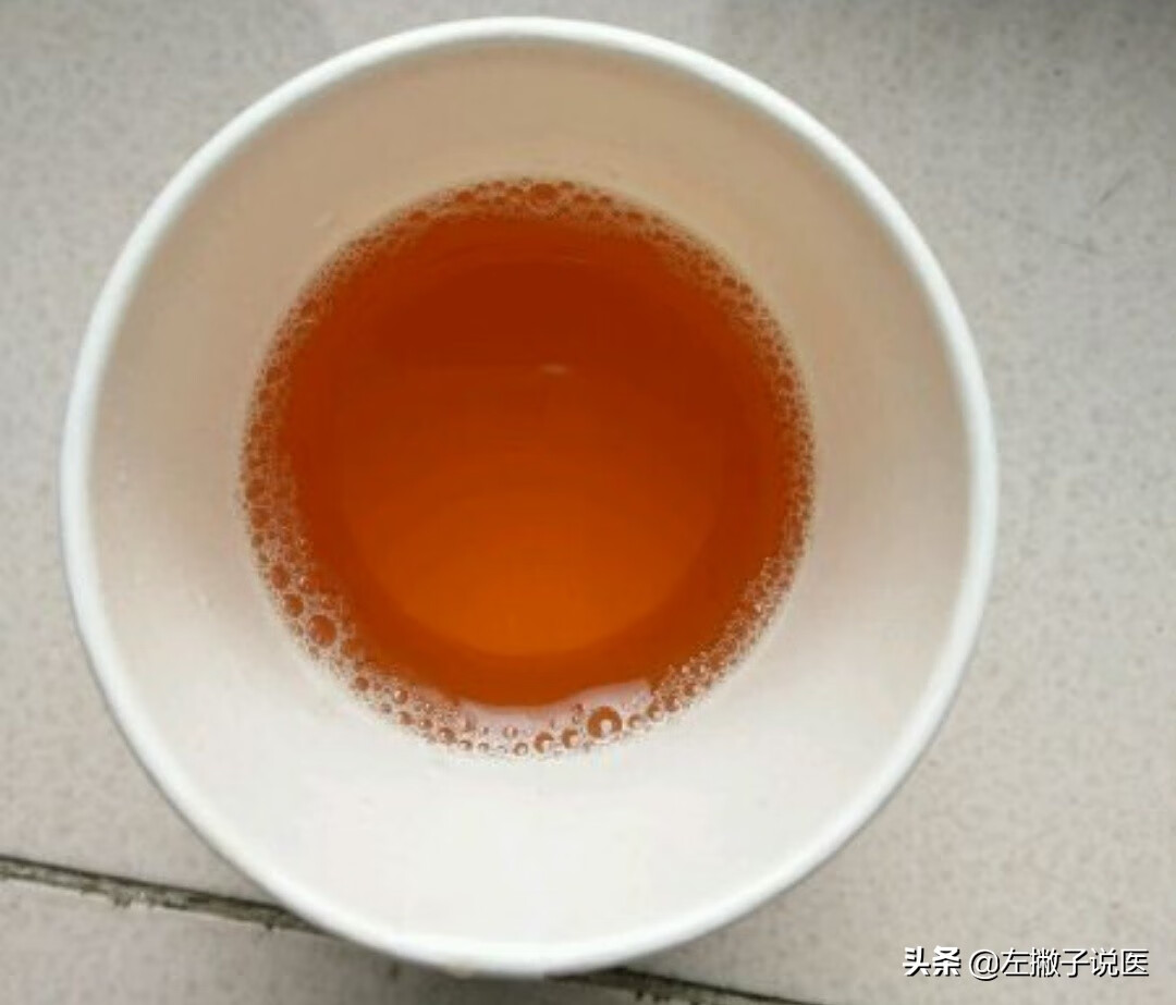 小便发黄是什么原因(小便发黄是什么问题)