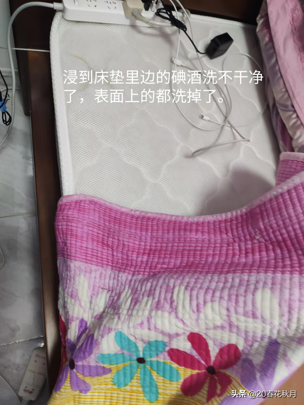 碘酒怎么洗得掉(碘酒的黄印子怎么洗)