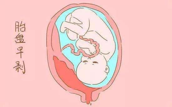胎盘位于子宫前壁是什么意思(胎盘位于子宫前壁及宫底)