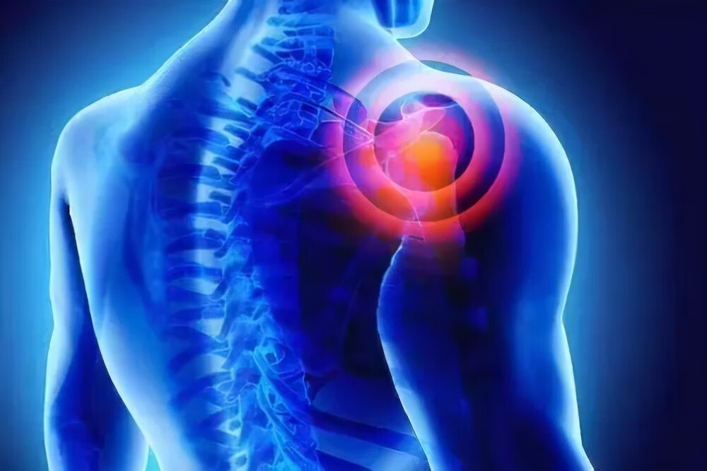 肩膀疼痛是什么原因引起的(肩膀疼痛是什么原因造成的)