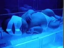 母乳喂养性黄疸怎么办(母乳喂养黄疸)