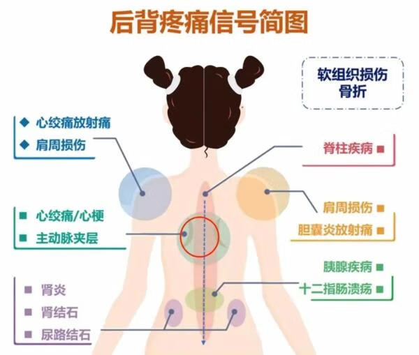 身体背部疼痛的原因(后背里面疼痛是什么原因)