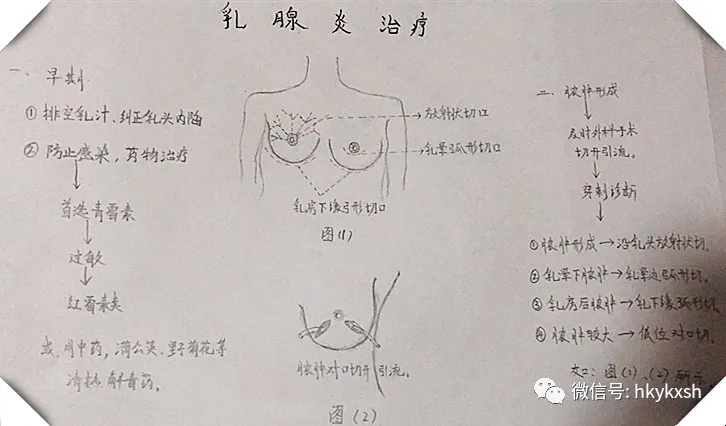 急性乳腺炎怎么办(乳腺炎怎么调理最好方法)