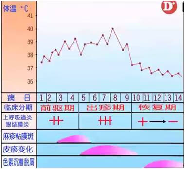 麻疹症状及原因(麻疹什么症状)
