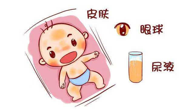 新生儿宝宝护理(新生儿基础护理)