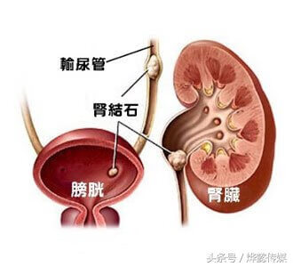 金钱草功效与作用是什么(金钱草功效主治)