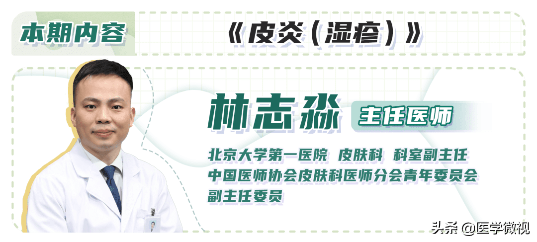 湿疹治疗容易么(慢性湿疹到底能不能治好)
