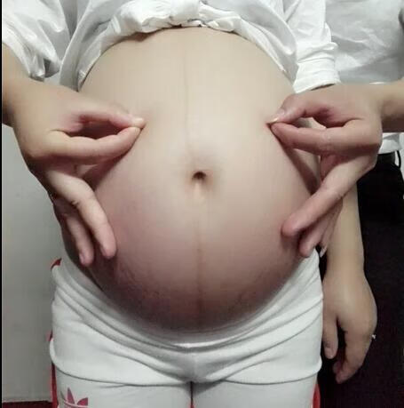 孕妇难产是什么原因引起的(孕妇难产怎么办)