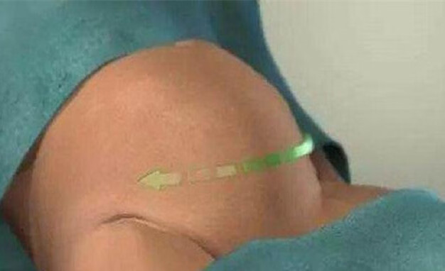 剖宫产和剖腹产的区别(剖腹产坐月子十大禁忌)