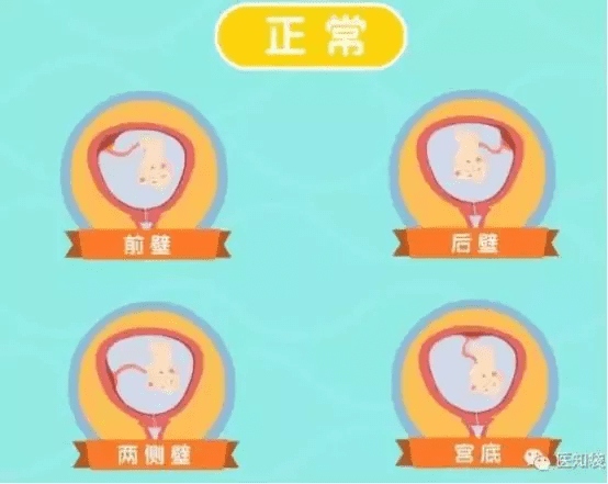 产检胎位roa是什么意思胎位roa是什么位置