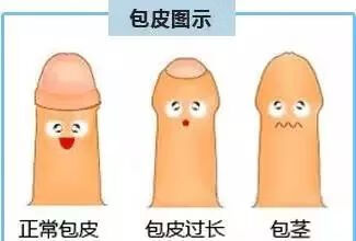 龟头敏感(什么药能根治龟头敏感)