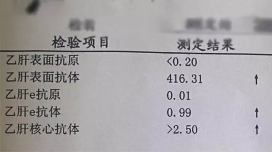 乙肝dna检测结果怎么看(乙肝病毒DNA检测报告)
