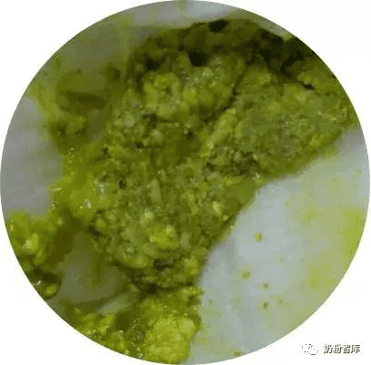 三个月宝宝大便绿色条状(3个月宝宝拉绿色大便)