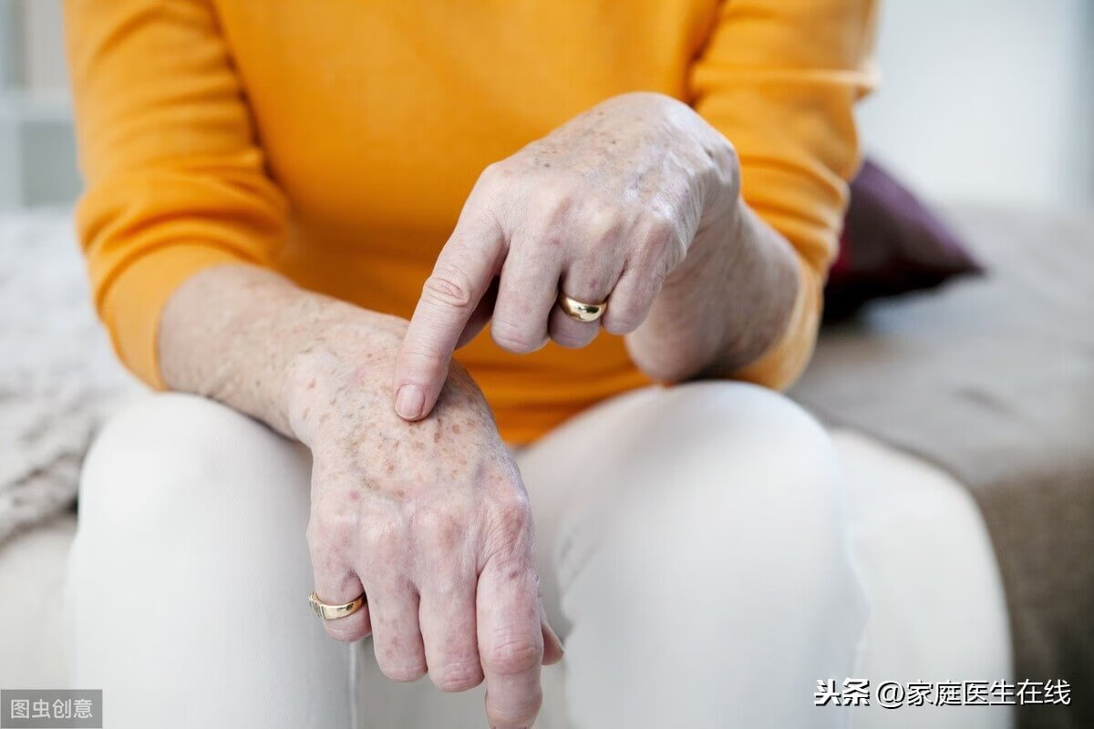 脸上起老年斑怎样去除(脸上长老年斑怎么样才能去除)