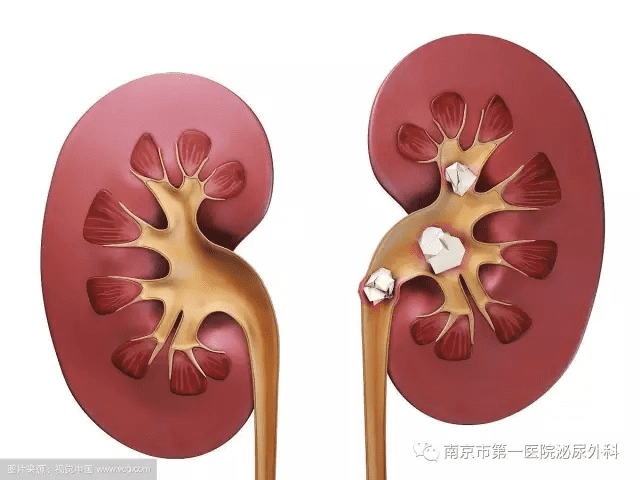 泌尿疾病治疗(泌尿外科)