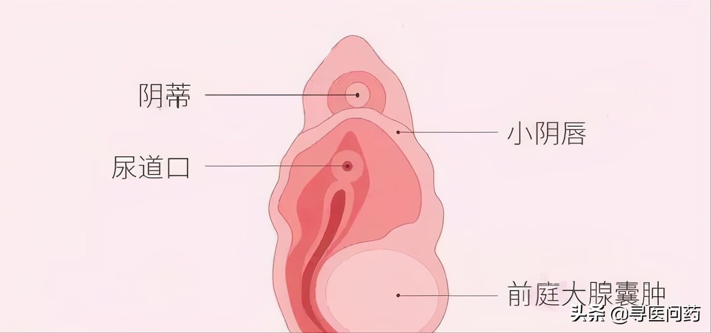 下面囊腫是什么病嚴重嗎女性(婦科附件囊腫是什么病嚴重嗎)