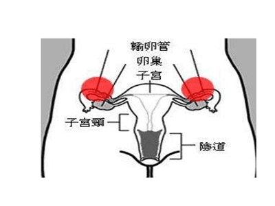 宫颈囊肿怎么治疗最好方法