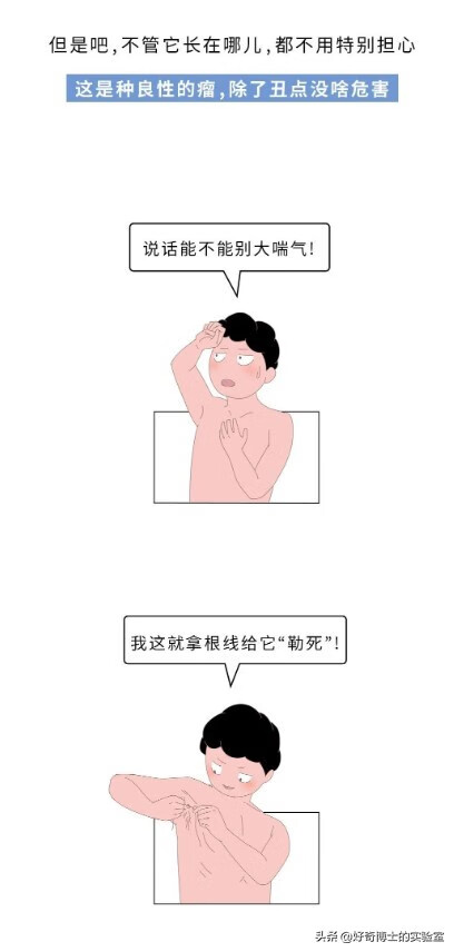 纤维瘤图片(纤维瘤是什么病)