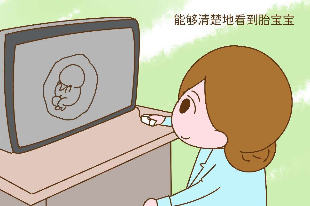 胎儿四维彩超照片做了很多次(婴儿四维彩超图片)