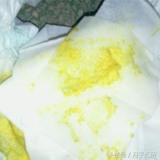 宝宝大便黑色颗粒(宝宝大便有点黑色)