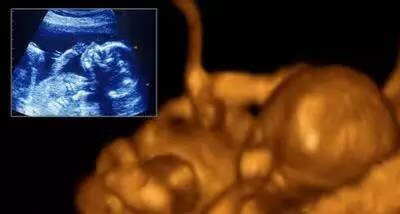 怀孕胎儿发育过程图片(宝宝胚胎发育过程图)