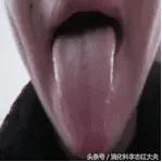 海螵蛸的副作用是什么(海螵蛸副作用都有哪些)