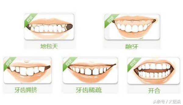 整形牙齿(牙齿整形都可以怎么整)
