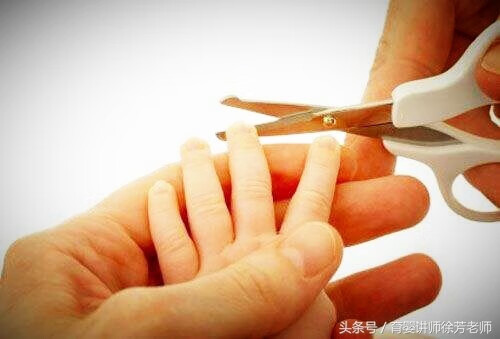 宝宝湿疹图片(小儿干性湿疹)