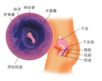 怀孕2个月胎儿图片(怀孕6周胎儿真实图片 有多大)