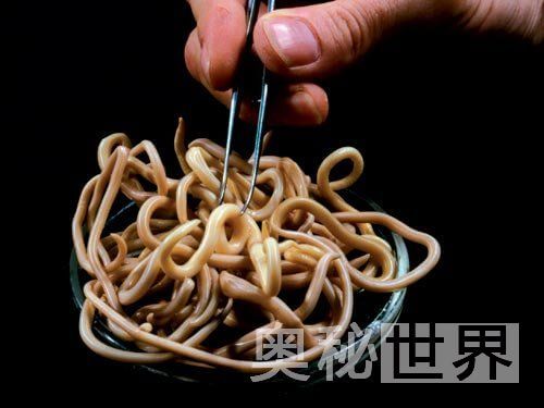 人体寄生虫有哪些(人体寄生虫图片)
