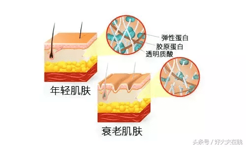 美容祛皱嫩肤(美容去皱纹的最好方法)