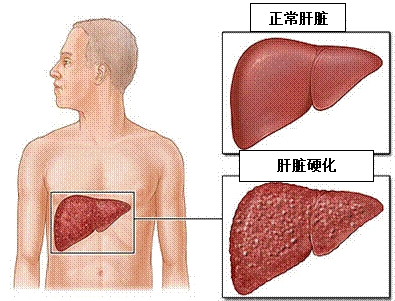乙肝核心抗体呈阳性说明什么(乙肝核心抗体一项阳性)
